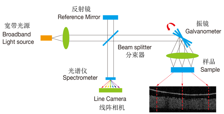 OCT�@΢�z�y�x